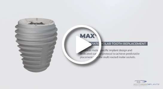 Southern Implants MAX / SInergy